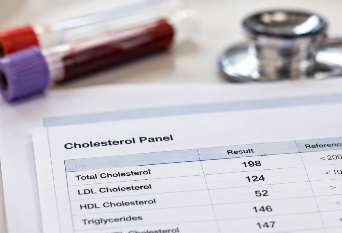 Your Cholesterol Panel Is Missing Most of Your Heart Risk
